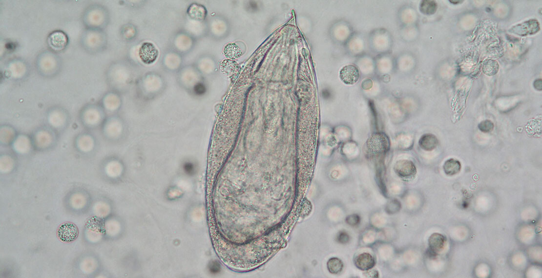 schistosomahaematobiumeiinurine400xvergrootfotoitgedit
