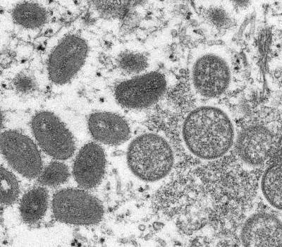 microscope-monkeypox