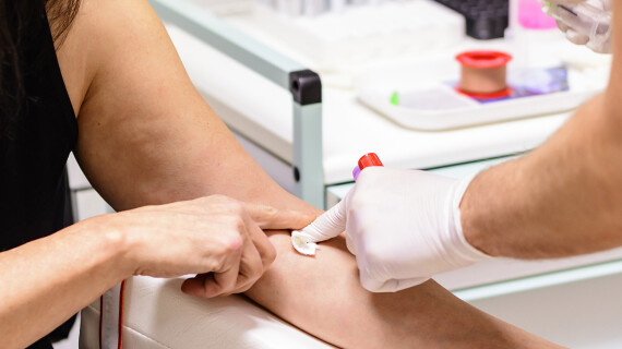 seksueel-overdraagbare-infecties