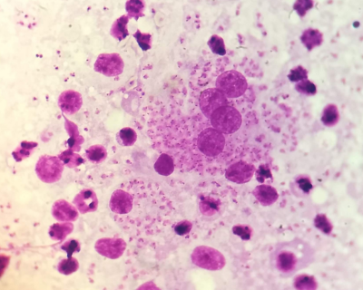 Leishmania