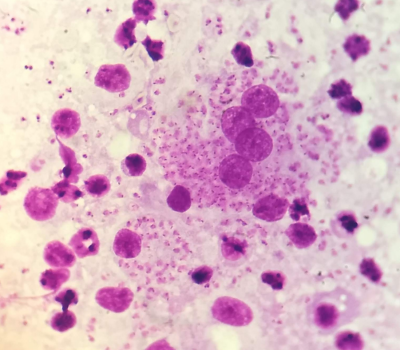 Leishmania
