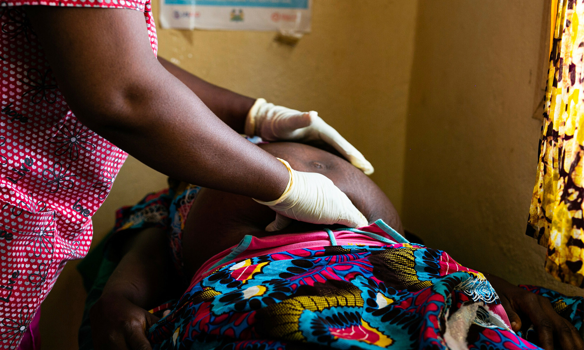 Mpox-in-pregnancy-header