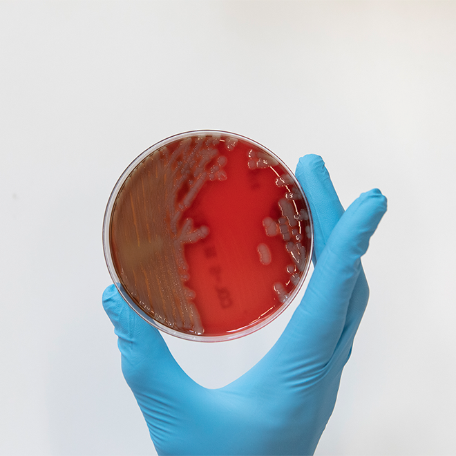 Antibiotic-resistance-1-resized