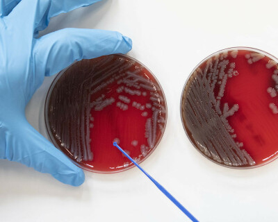 resistance-to-antibiotics-lab-copy