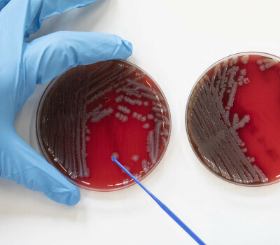 resistance-to-antibiotics-lab-copy