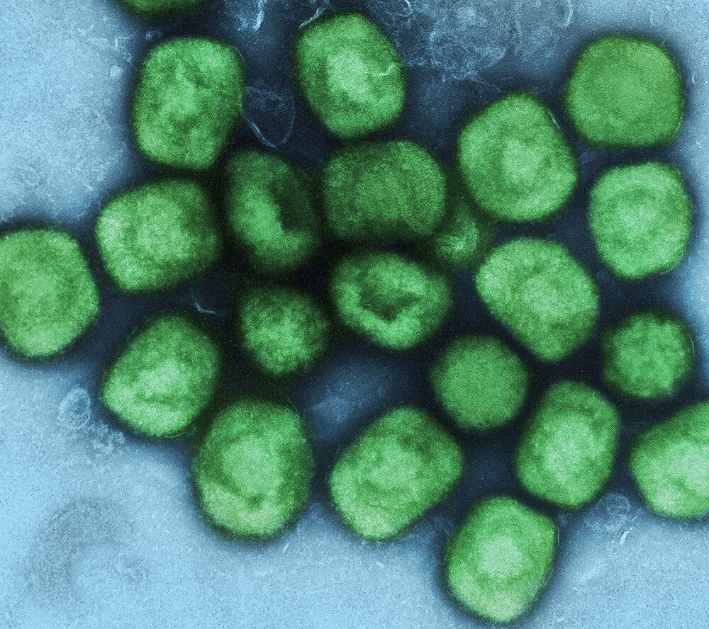 Colorized_transmission_electron_micrograph_of_monkeypox_virus_particles_(green)_v2