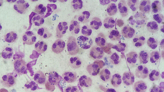 FOTJ-2026-april-ngonorrhoeae_2000x1200