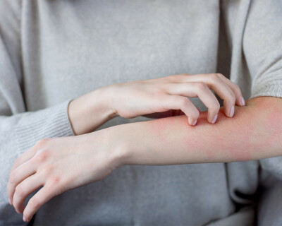 scabies-study-header