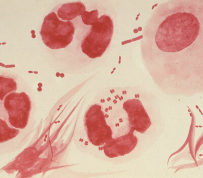 neisseriagonorrhoeaephil3693lores