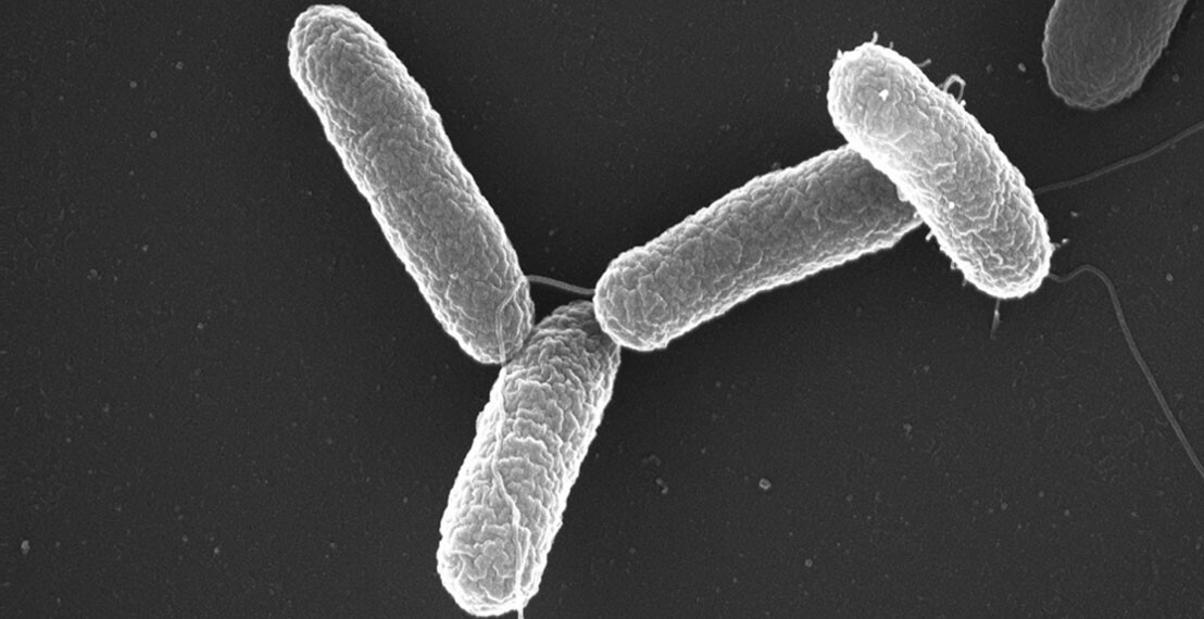 salmonellatyphimuriumphotomaxplanckinstituteforinfectionbiology