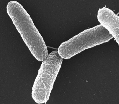 salmonellatyphimuriumphotomaxplanckinstituteforinfectionbiology