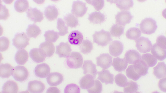 PlasmodiumFalciparum_5x4