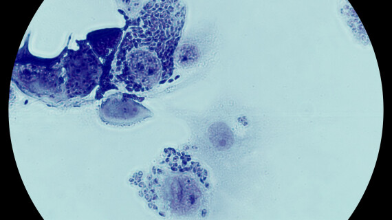 FOTJ_Leishmania_5x4