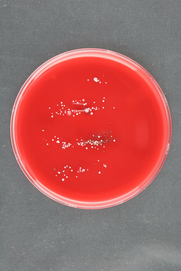220