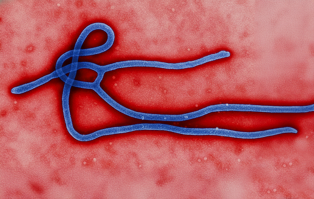 magnifics_upscale-precision-g06Nm8LYsfzdZVQ8zh00-Gemini_Generated_Image_1rkjt31rkjt31rkj_Big_Color 1 1