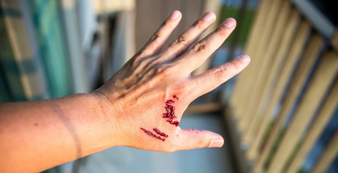 bite