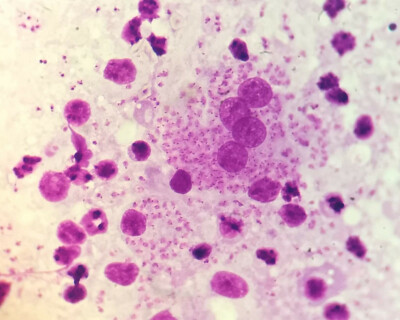 Leishmaniasis-header