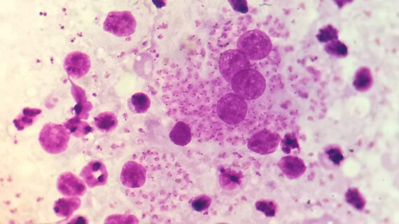 Leishmaniasis-header