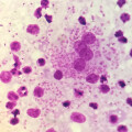 Leishmaniasis-header
