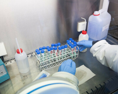 tuberculose-stammen-labo-itg