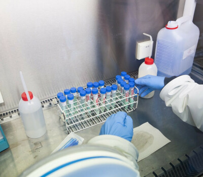 tuberculose-stammen-labo-itg