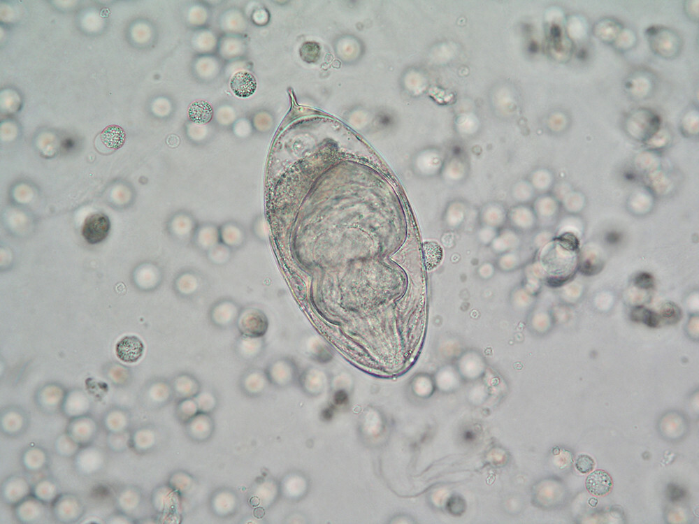 Schistosoma haematobium Ei urine 400x (4)_smaller