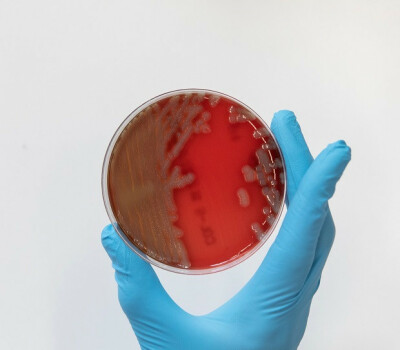 antimicrobial-resistance-amr