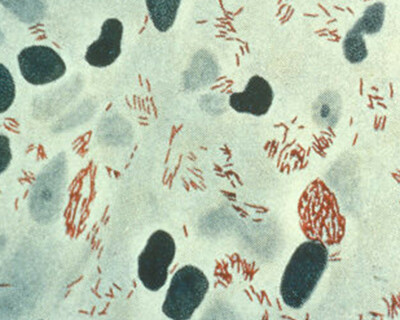 MycobacteriumLeprae_resized