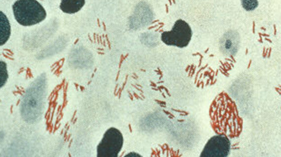 MycobacteriumLeprae_resized