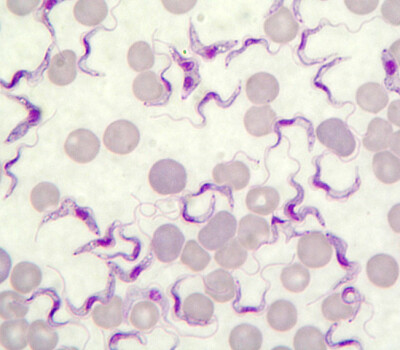 trypanosomabruceiuitstrijkgiemsa1000x1copy