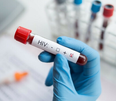hiv-test-positive-itm-clinics