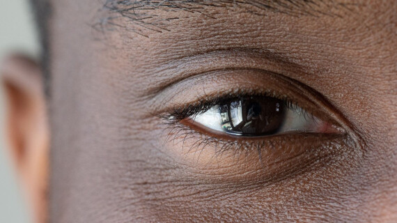 3_CornealDisease_5x4