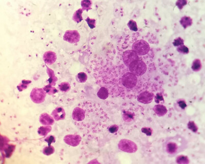 Leishmaniasis-opengraph