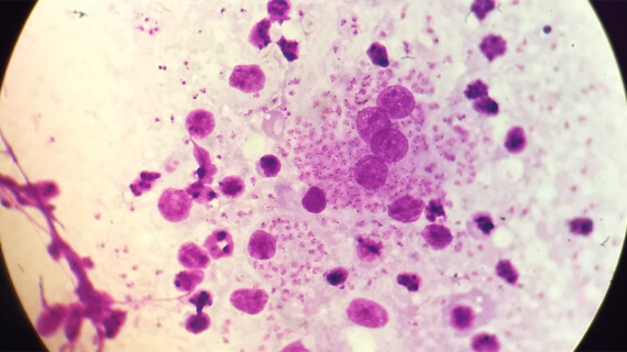 Leishmaniasis-opengraph