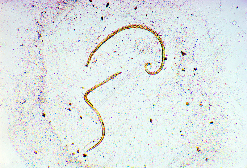 Trichinella-Spiralis