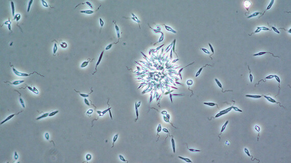 leishmaniapromastigotenfasecontrast500x1fin