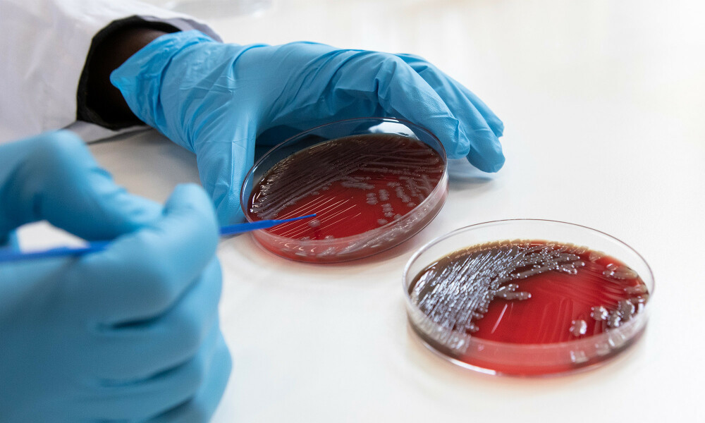 institute-of-tropical-medicine-research-1
