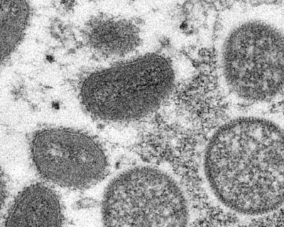 Electron microscopic (EM) image depicting mpox virus particles (Copyright CDC)