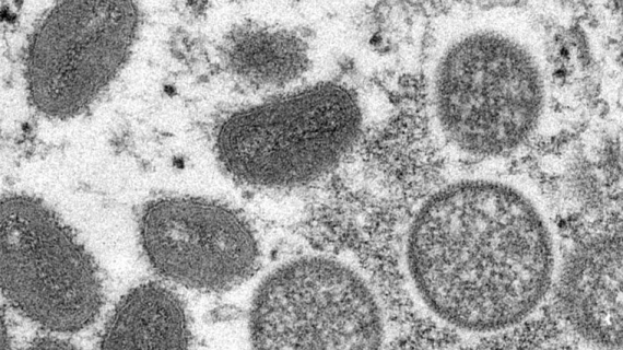 Elektronenmicroscopisch (EM) beeld van mpox-virusdeeltjes (Copyright CDC)