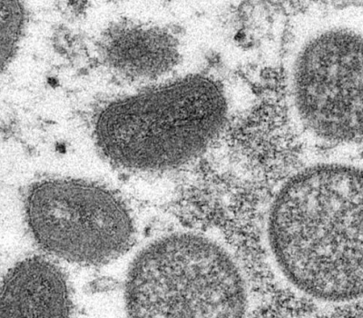 Electron microscopic (EM) image depicting mpox virus particles (Copyright CDC)